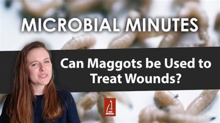 Maggot Therapy Is The Disgusting Medical Practice That Will Save Your Life